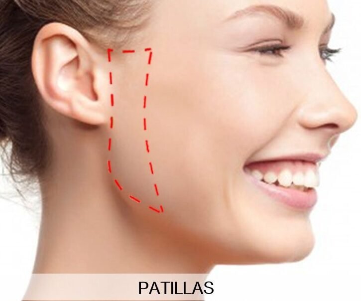 depilación de patillas
